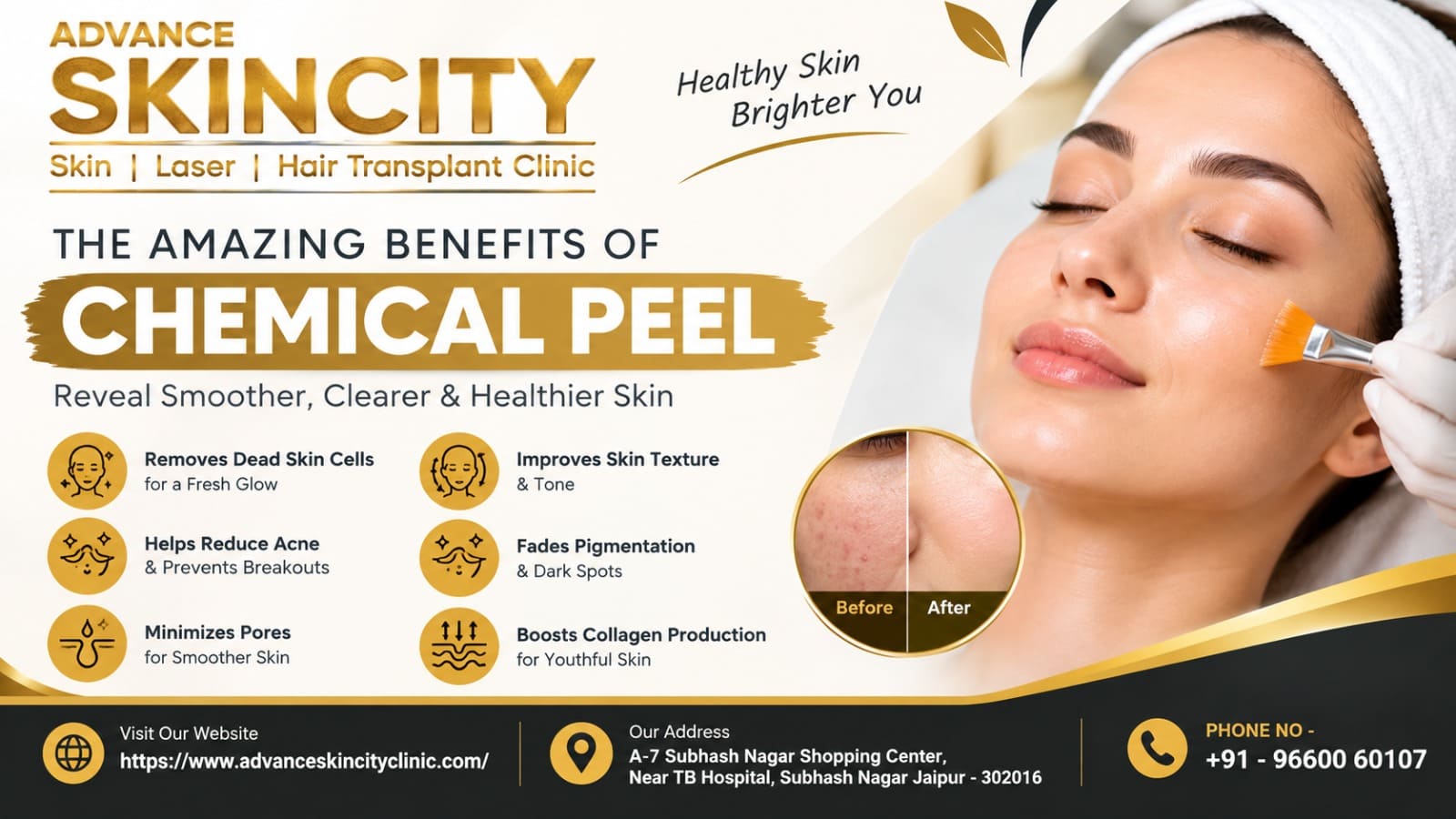 Chemical Peels Benefits