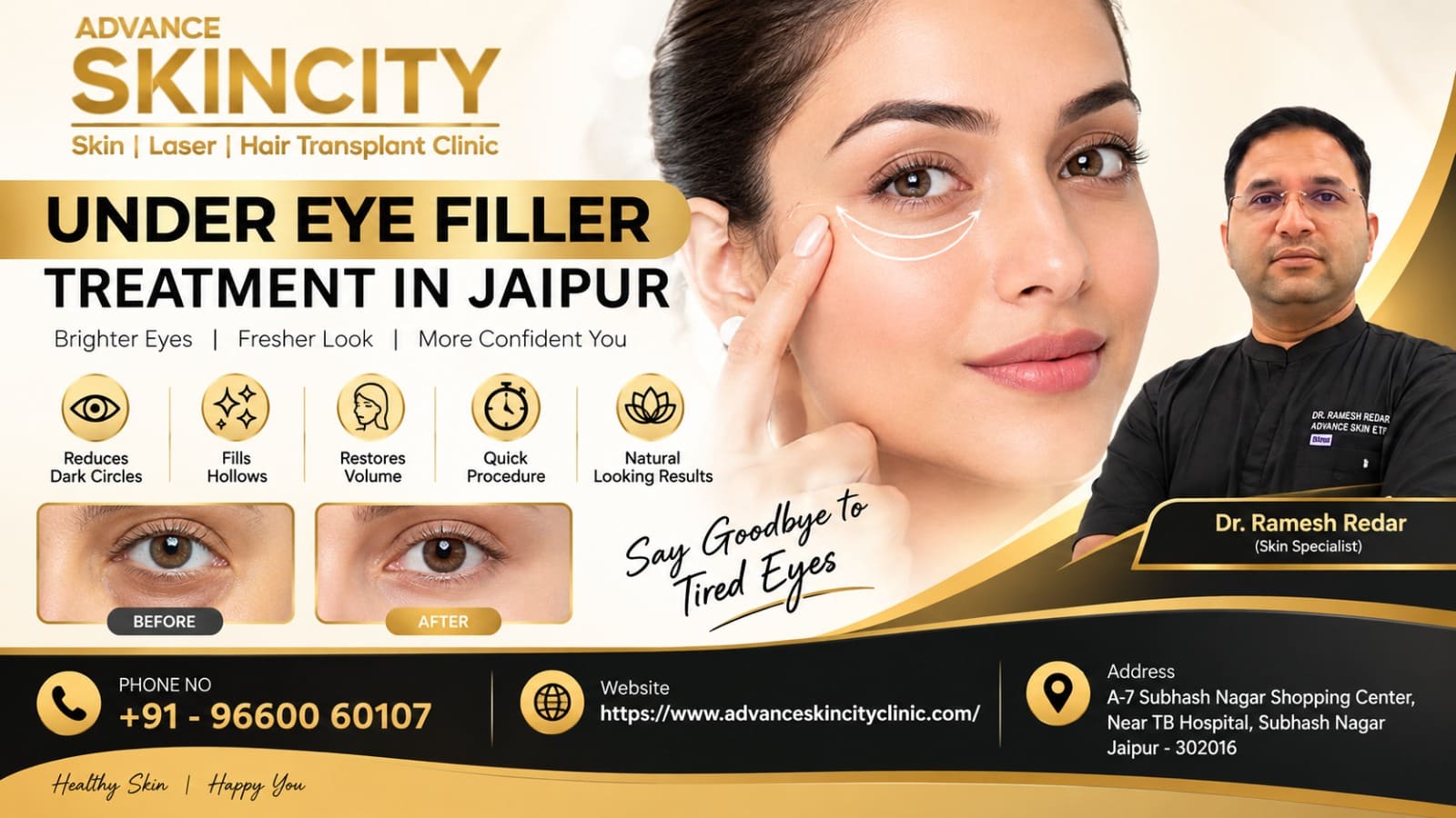 under eye filler treatment