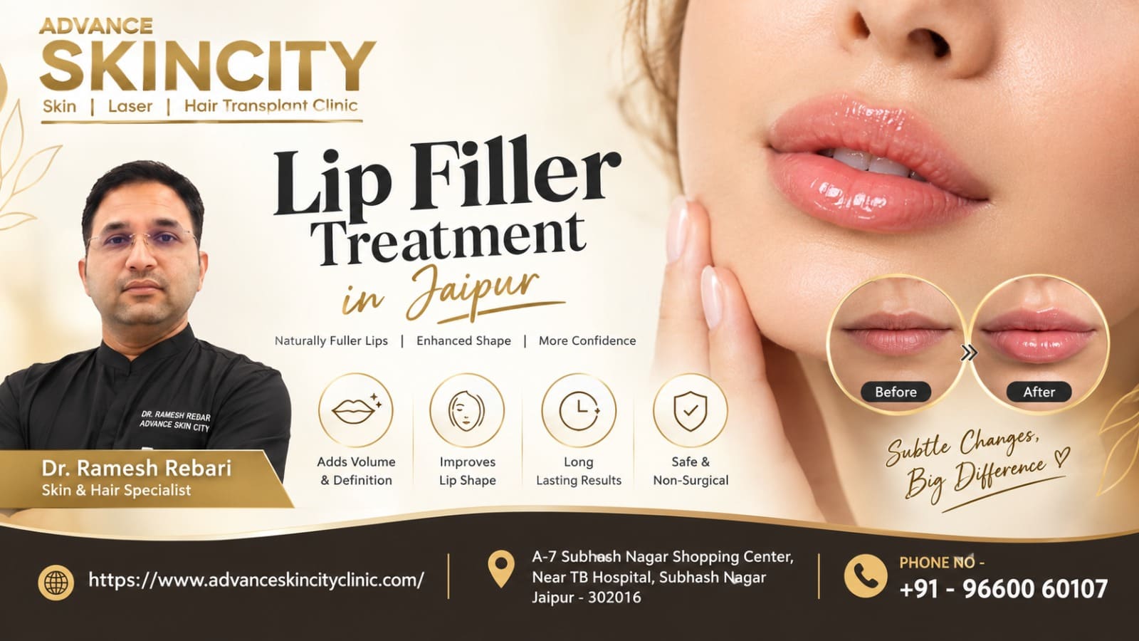 Lip Filler Treatment