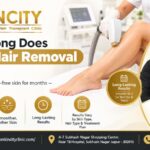 How Long Does Laser Hair Removal Last?