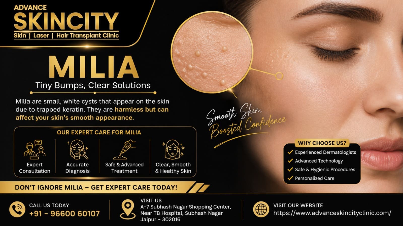 milia on face